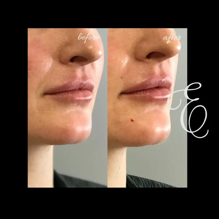 Esthetics Center New England Picture 10