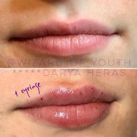 DH Estetika Waltham ico