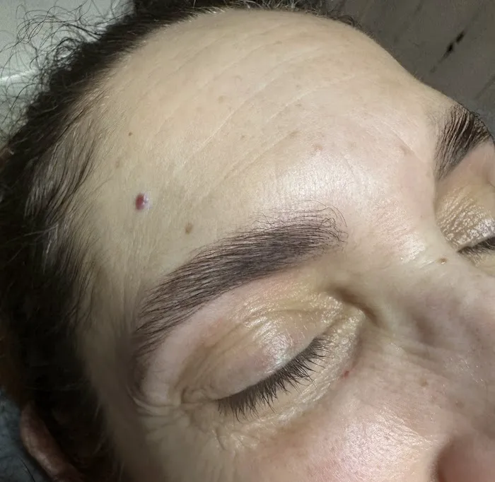 Birch Tree Esthetics Picture 4