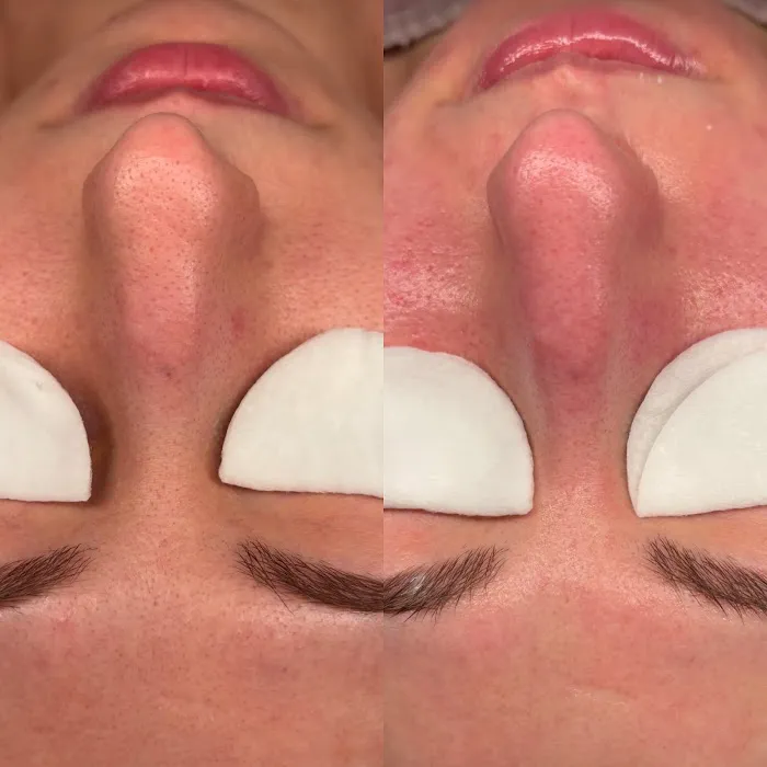 Glow by the Bay Skincare Picture 8