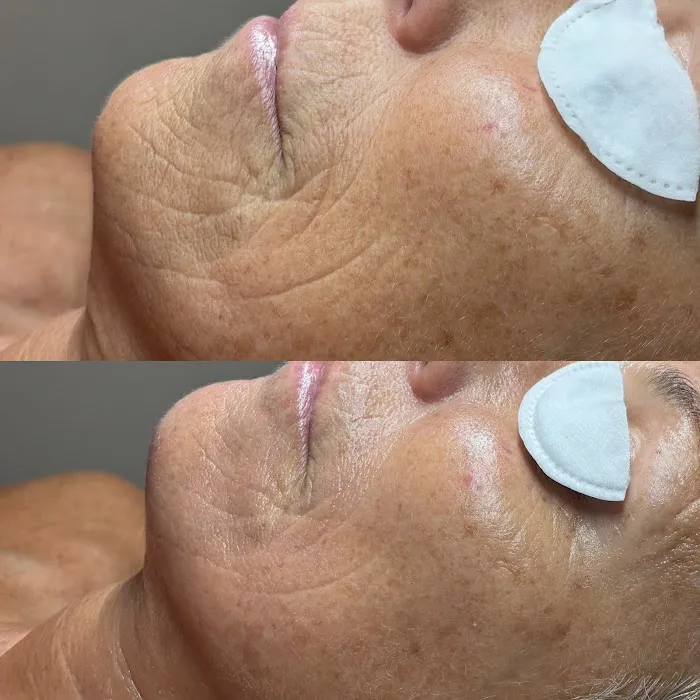 Glow by the Bay Skincare Picture 10