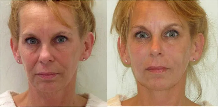 Visage Sculpture Picture 1