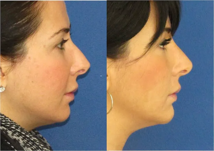 Visage Sculpture Picture 4