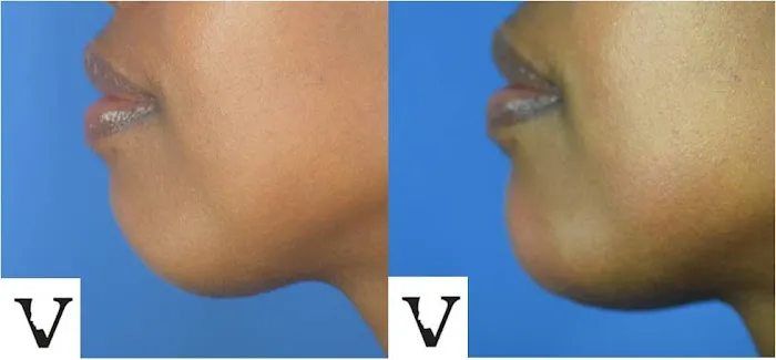 Visage Sculpture Picture 8