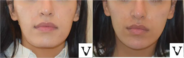 Visage Sculpture Picture 9