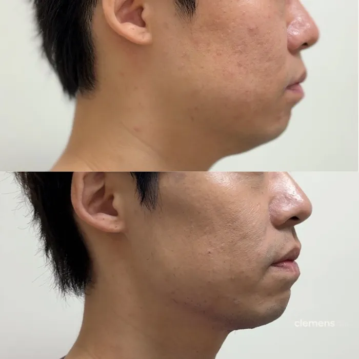 Clemens Face + Body Picture 3