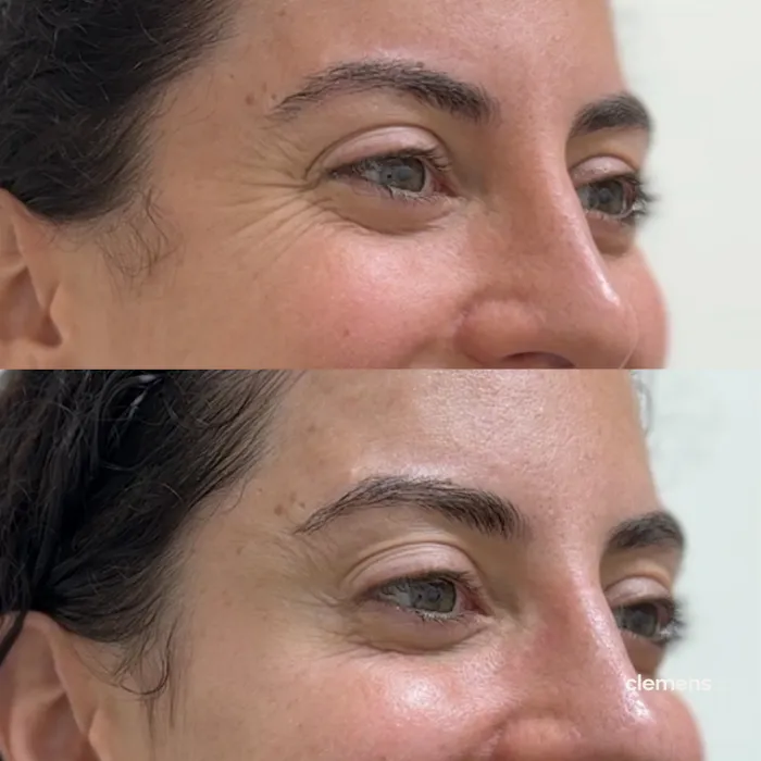 Clemens Face + Body Picture 4