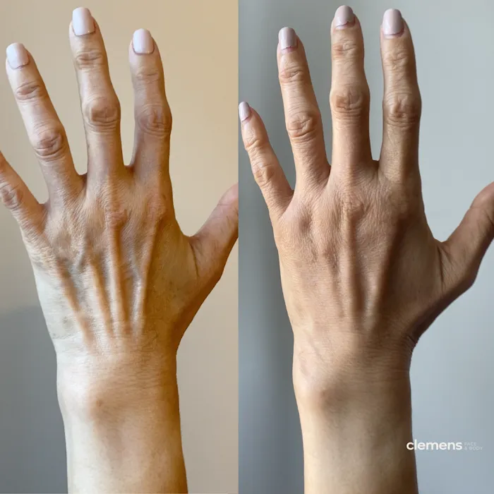 Clemens Face + Body Picture 5