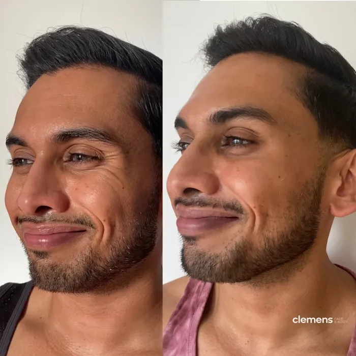 Clemens Face + Body Picture 6