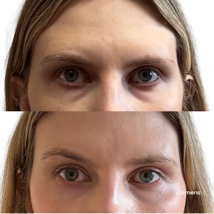 Clemens Face + Body Picture 7