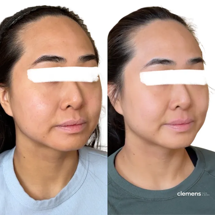 Clemens Face + Body Picture 8