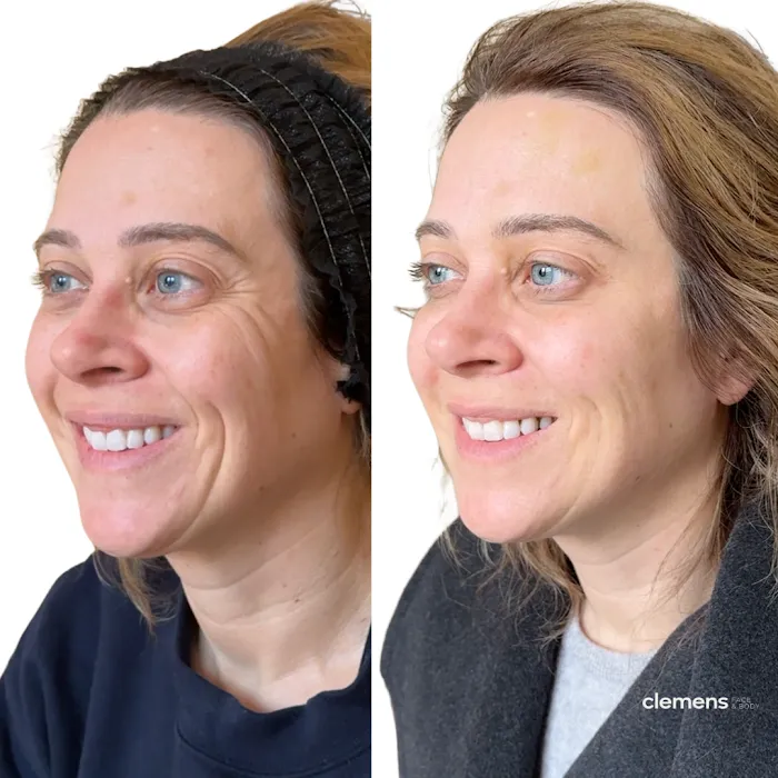 Clemens Face + Body Picture 9