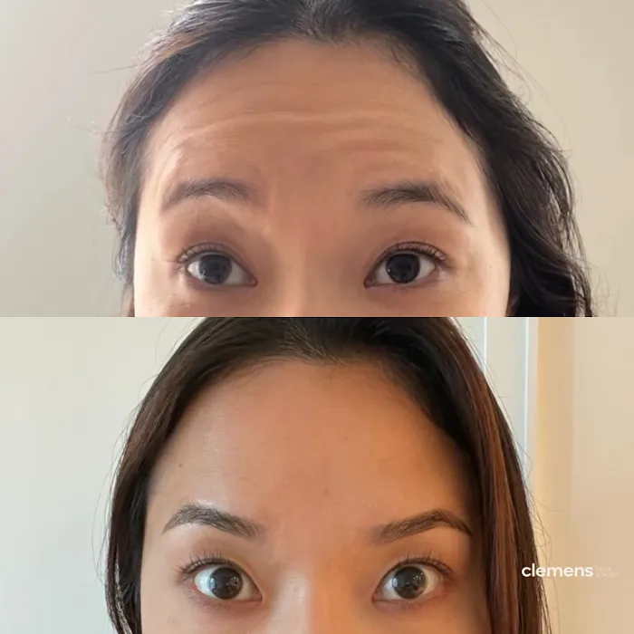 Clemens Face + Body Picture 10