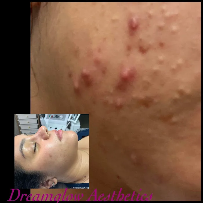 DreamGlow Aesthetics skin studio/photography Picture 7