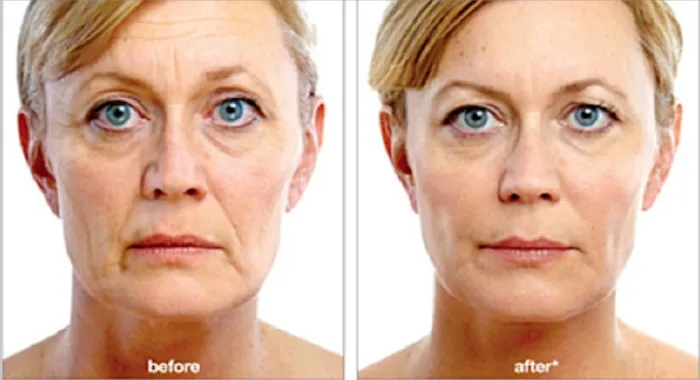 CollaJenn Aesthetics Picture 4