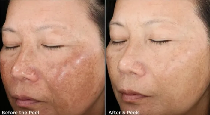 CollaJenn Aesthetics Picture 6