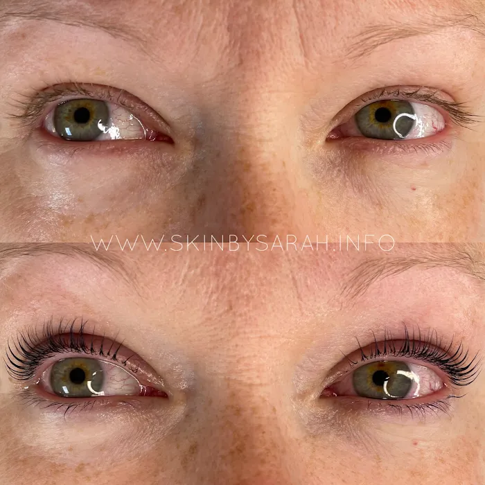 Skin By Sarah Picture 6