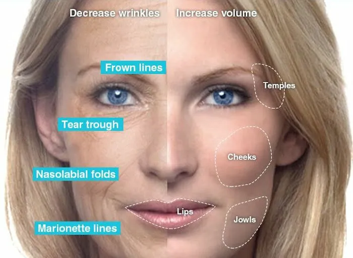 CollaJenn Aesthetics Picture 5