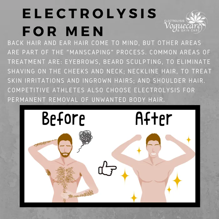 Voguecare Electrolysis & Skin Care Picture 8