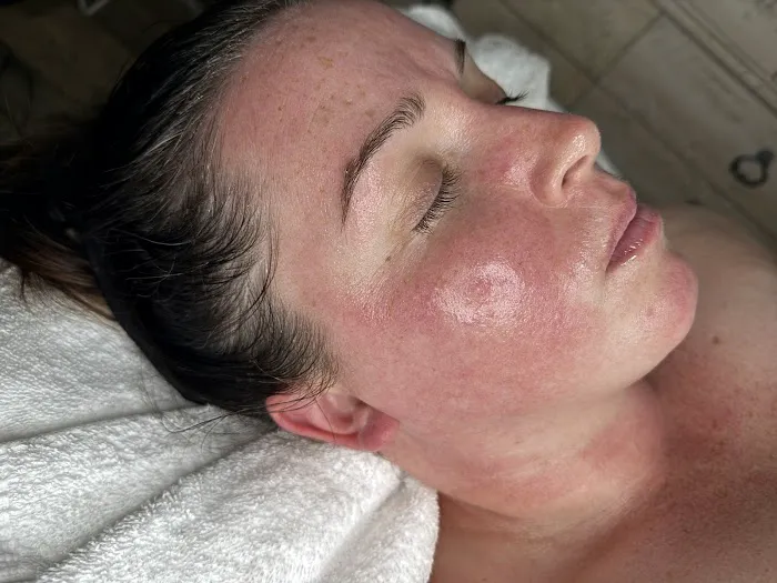 Mackenzie Rose Esthetics LLC Picture 3