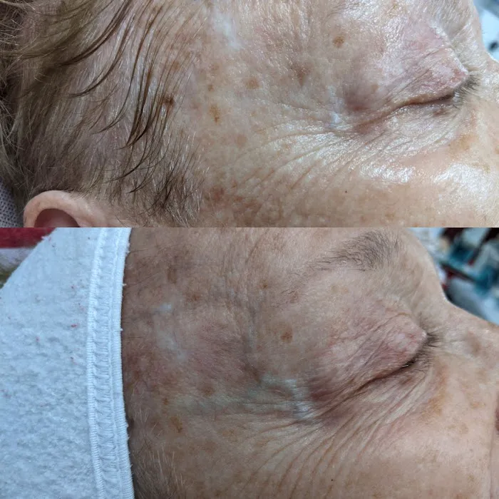 Visible Difference Picture 5