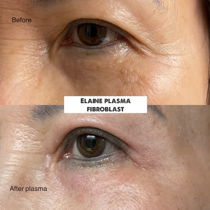 La Beauty Spa Picture 2