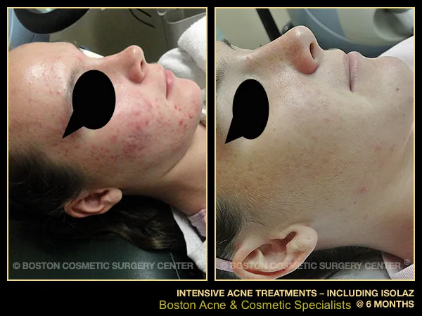 Boston Acne Specialists Picture 1