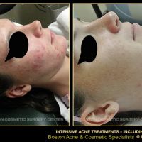 Boston Acne Specialists ico