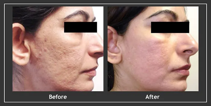 Boston Acne Specialists Picture 4