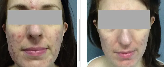 Boston Acne Specialists Picture 5