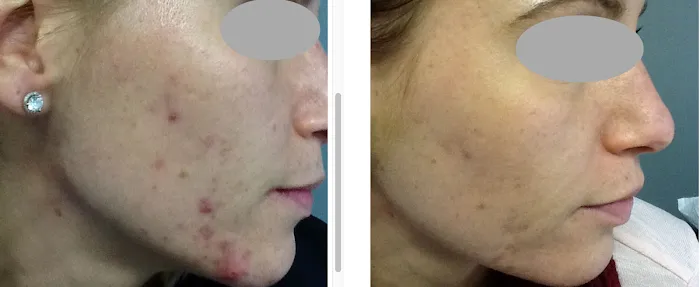 Boston Acne Specialists Picture 8