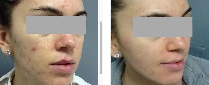 Boston Acne Specialists Picture 7