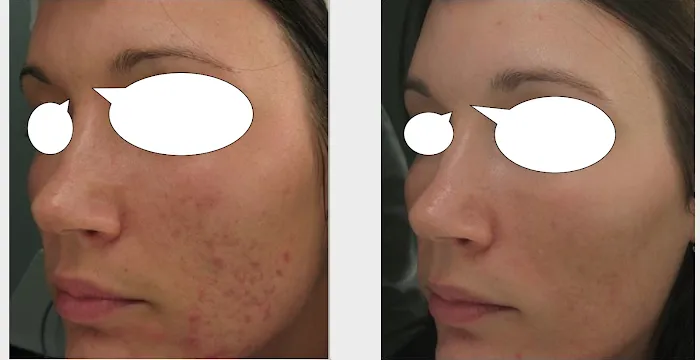 Boston Acne Specialists Picture 9