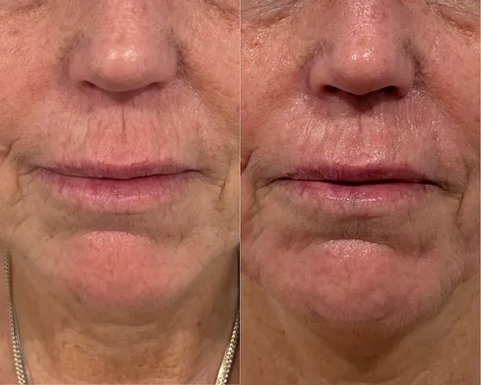 ILLUME Skin Spa Picture 9