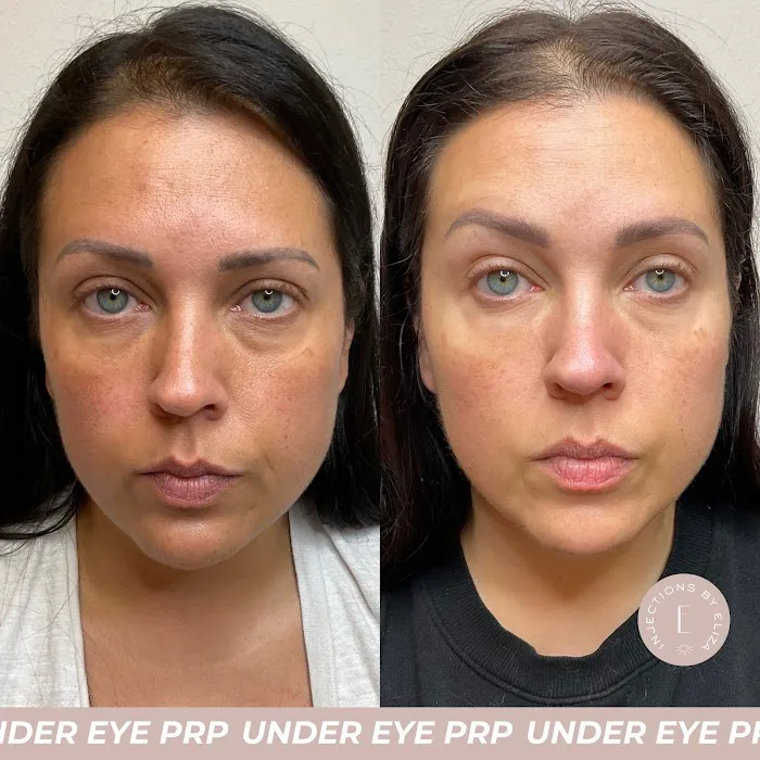 Injections by Eliza Picture 9