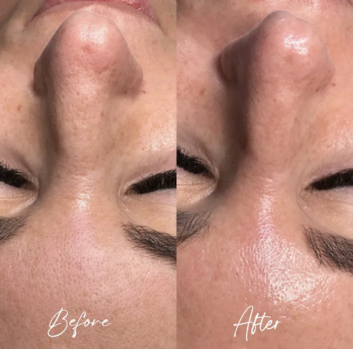 Glowing Beauty & Co | Skin Care Studio in Andover MA Picture 4