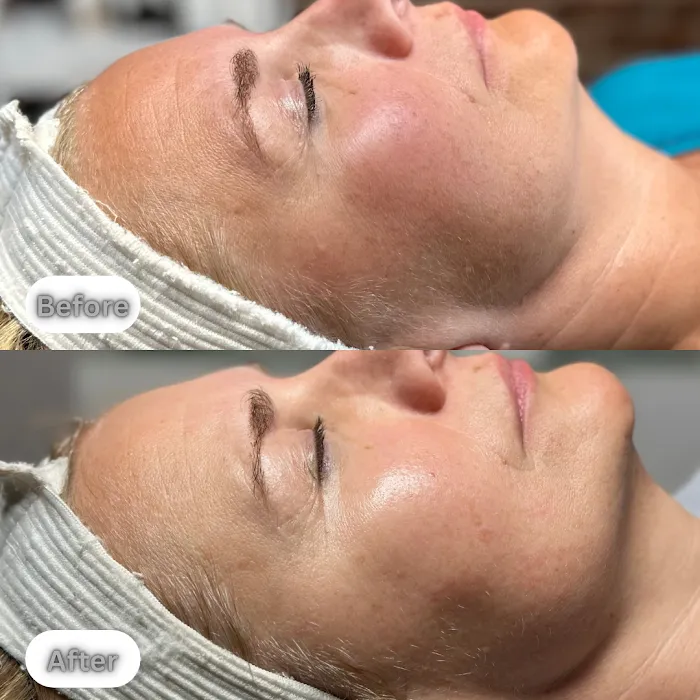Glowing Beauty & Co | Skin Care Studio in Andover MA Picture 9