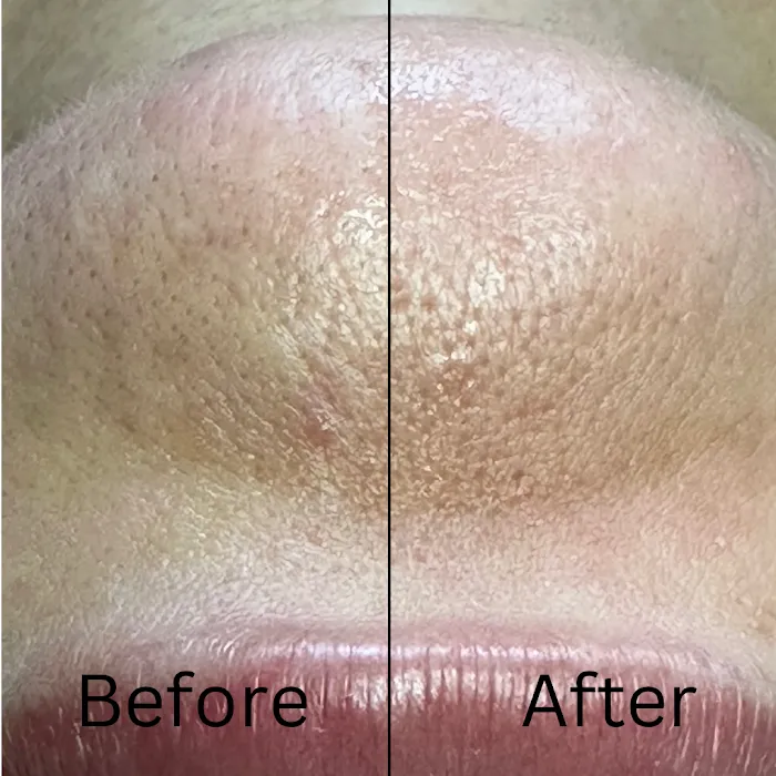 Glowing Beauty & Co | Skin Care Studio in Andover MA Picture 10