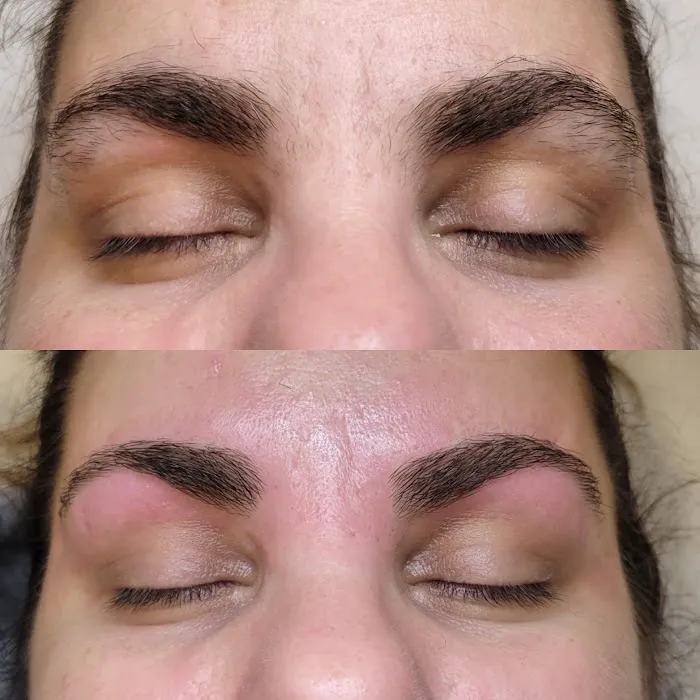 Purely Porcelain Esthetics Picture 7