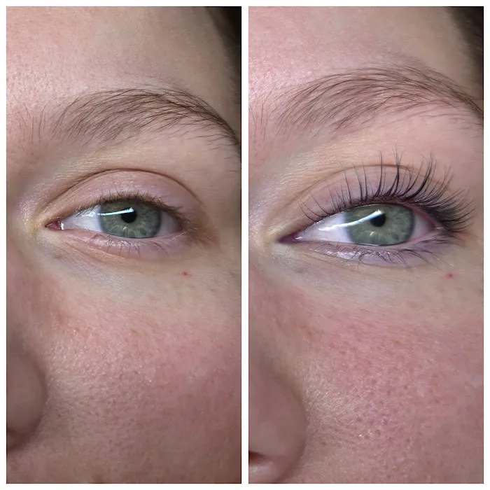 Purely Porcelain Esthetics Picture 4