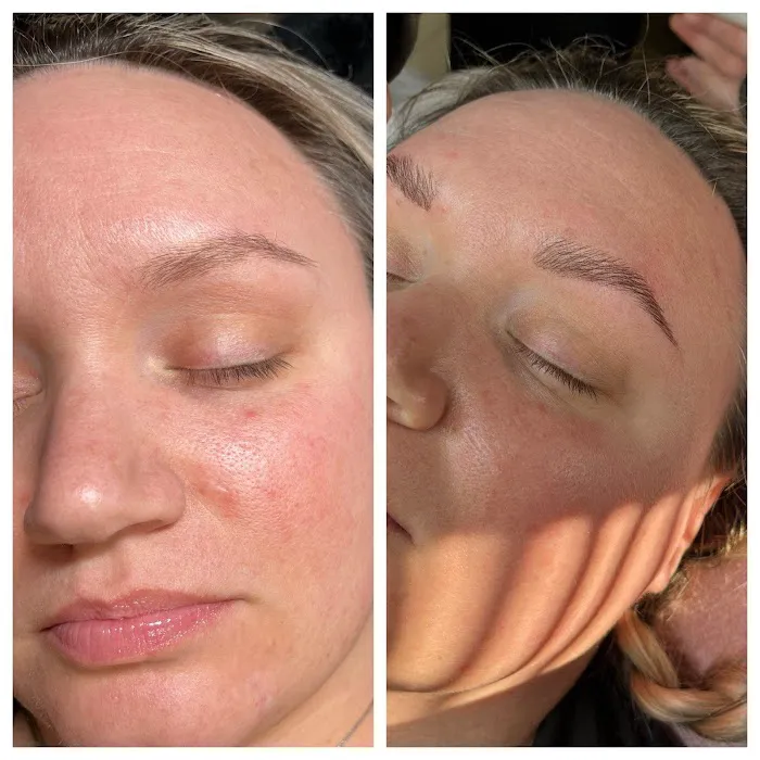 Purely Porcelain Esthetics Picture 6