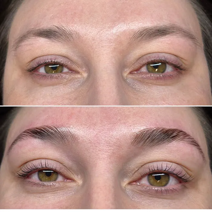 Purely Porcelain Esthetics Picture 3