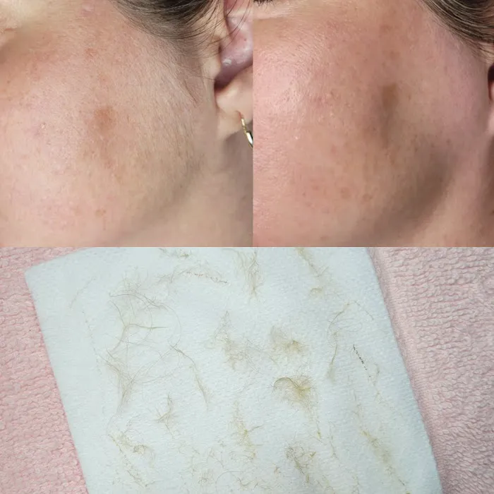 Purely Porcelain Esthetics Picture 8