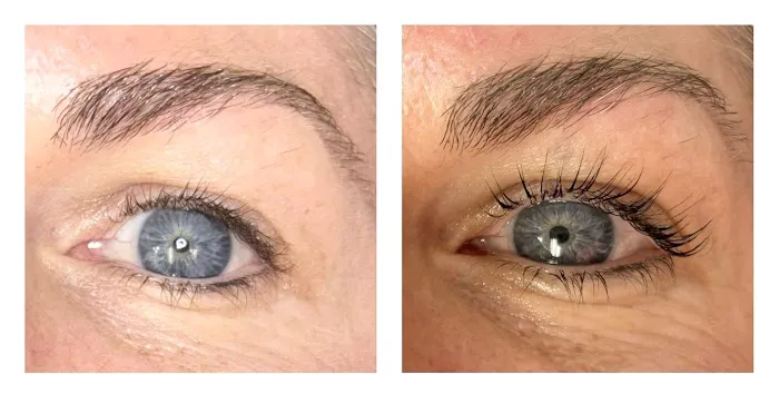 Skin Junkee Picture 3