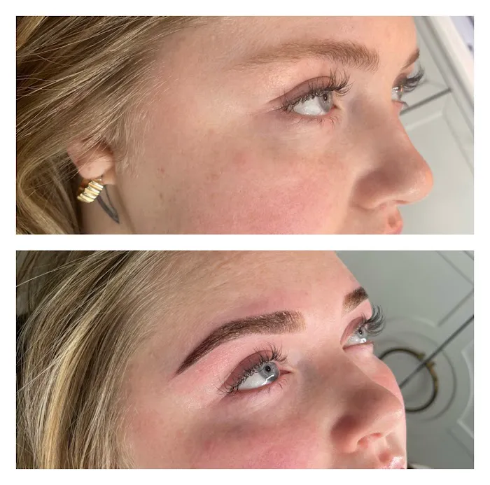 Skin Junkee Picture 9