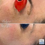 Laser Care Cosmetic LLC