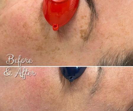 Laser Care Cosmetic LLC