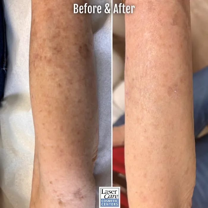 Laser Care Cosmetic LLC Picture 3