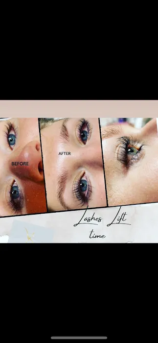 Vital Skin Picture 4