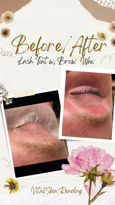 Vital Skin Picture 7